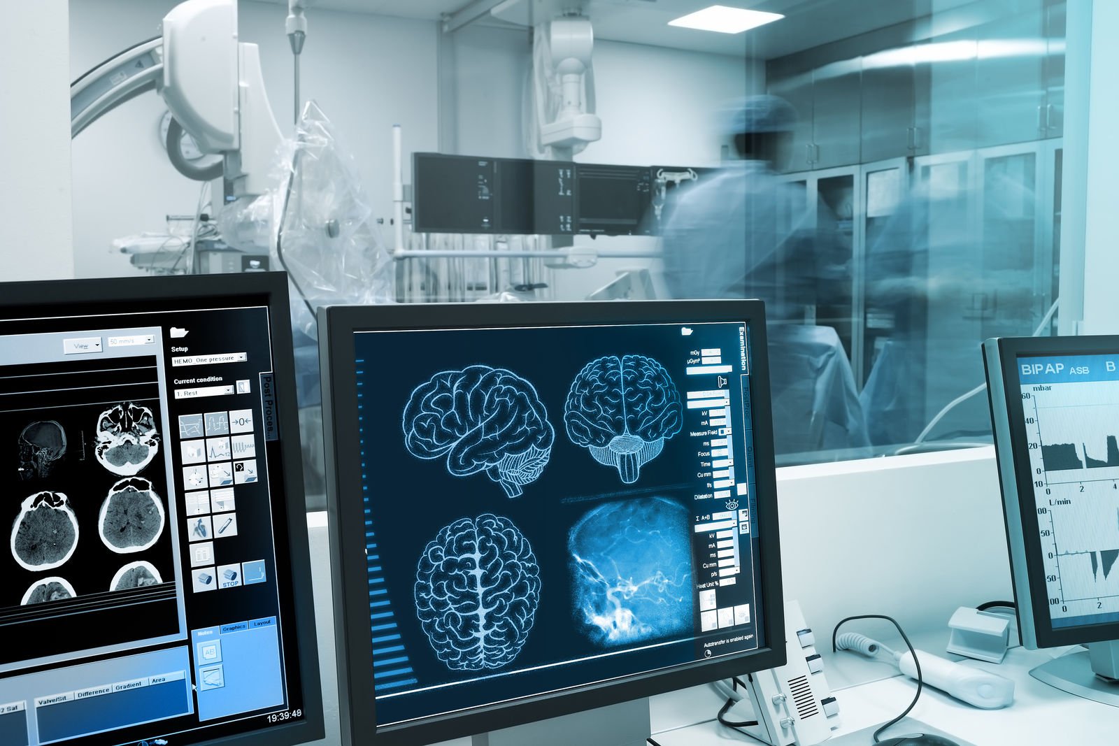 Compare Car Insurance Rates for Epileptic Drivers [2023]
